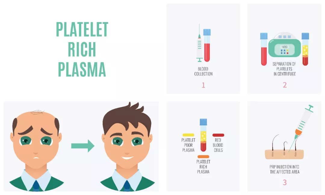 NADE DM0412P medical beauty low-speed Centrifuge LCD display 300-4500rpm for orthopedic, aesthetic surgery,oral surgery, etc.